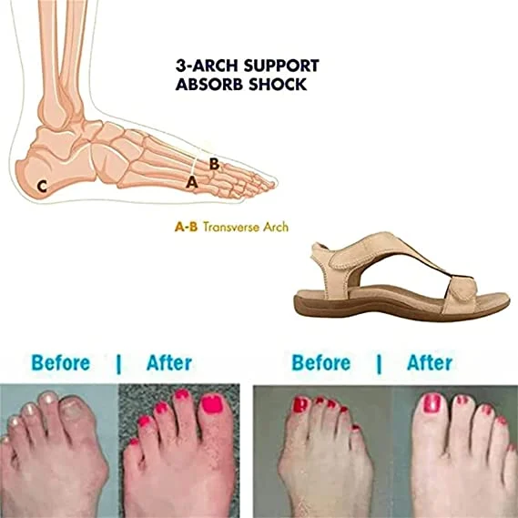 🔥  49% OFF🔥Skin adjustable orthotic sandals